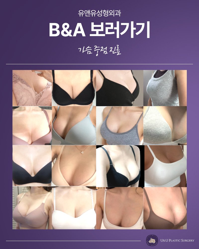 강남 성형외과 전문의